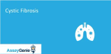 嚢胞性線維症：原因、遺伝、治療、診断