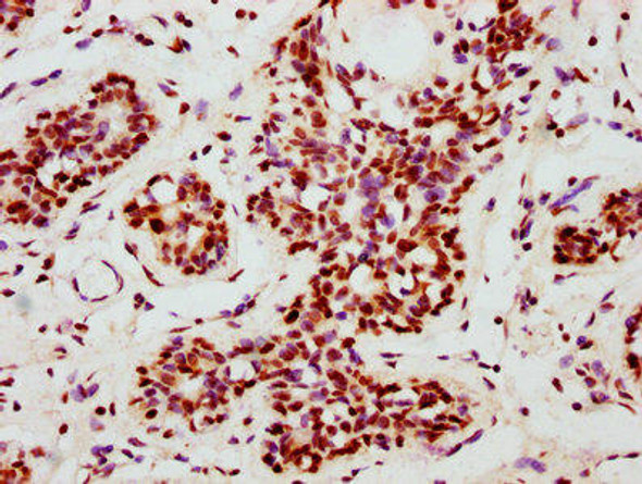 Anti-Phospho-NFE2L2 (S40) Antibody (RACO0066)