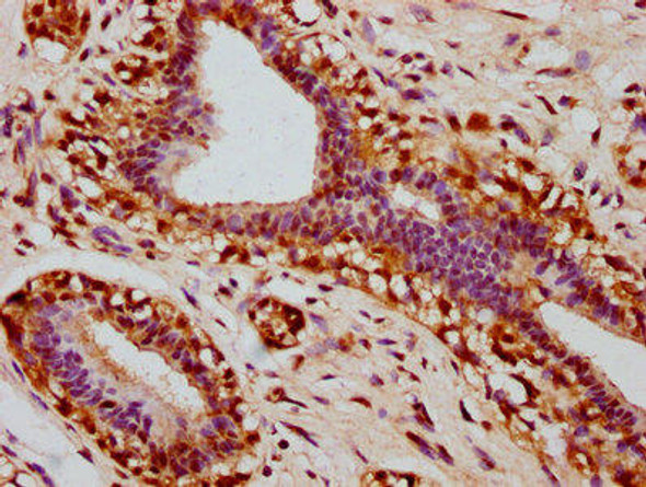 Anti-Phospho-STAT3 (S727) Antibody (RACO0080)