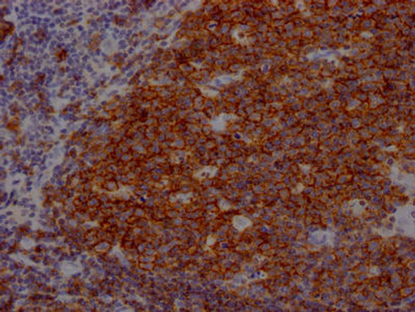 Anti-CD19 Antibody (RACO0397)