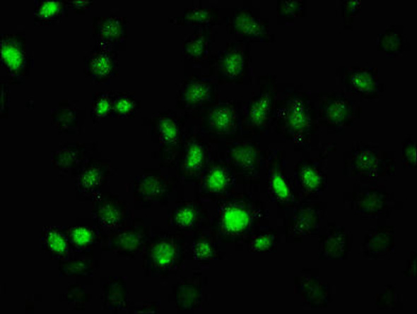 Anti-Phospho-PRKAA2 (Thr172) Antibody (RACO0074)