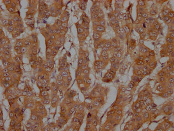 Anti-CASP3 Antibody (RACO0404)