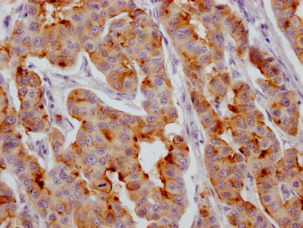 Anti-IGFBP2 Antibody (RACO0425)