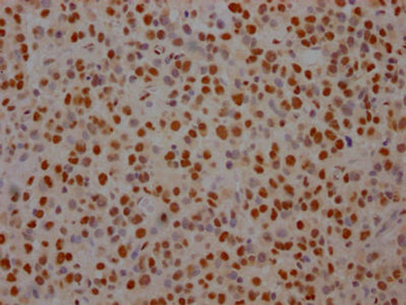 Anti-SF3B1 Antibody (RACO0493)