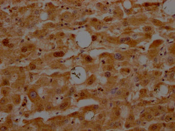 Anti-ATF5 Antibody (RACO0278)