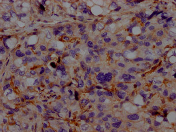 Anti-ACVRL1 Antibody (RACO0348)