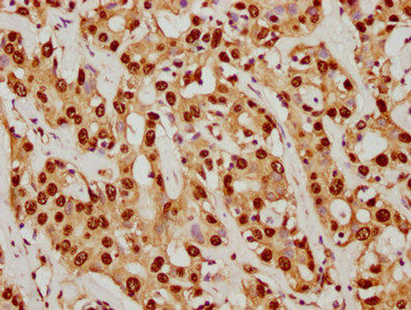 Anti-SUMO1 Antibody (RACO0156)