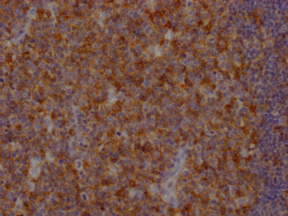 Anti-FAS Antibody (RACO0300)