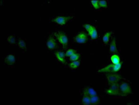 Anti-CXCR4 Antibody (RACO0304)