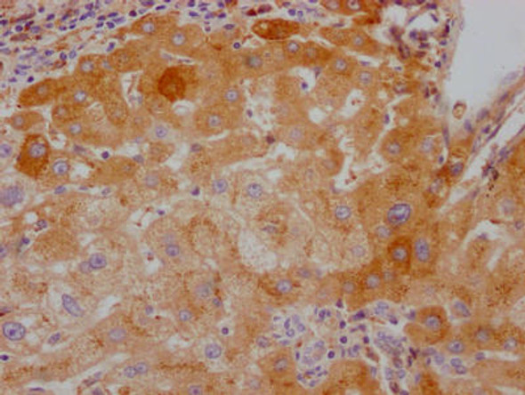 Anti-F10 Antibody (RACO0392)