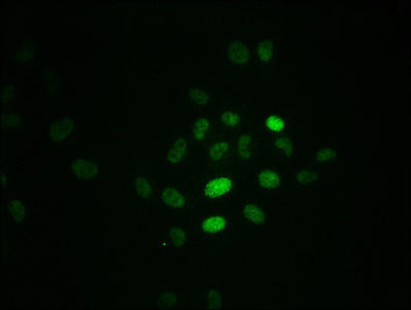 Anti-Phospho-RPA2 (T21) Antibody (RACO0082)