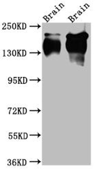 Anti-NTRK1 Antibody (RACO0539)