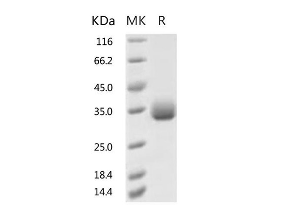 2019-nCoV Spike Recombinant Protein (V483A) (RPES0072)