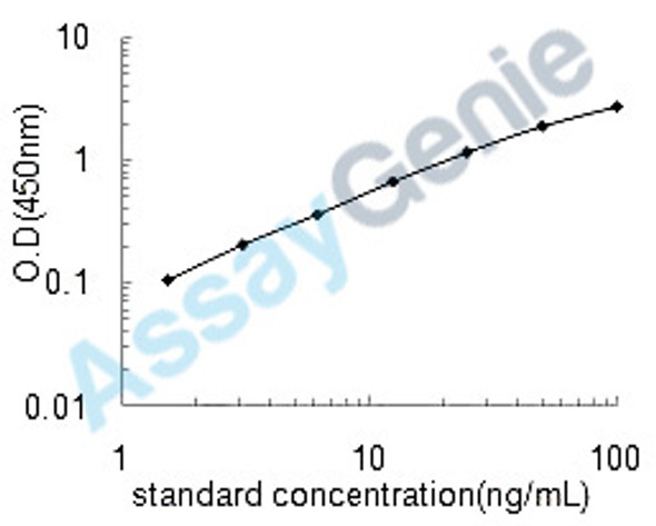 Human Hepatitis B virus X-interacting protein (HBXIP) ELISA Kit (HUEB1375)