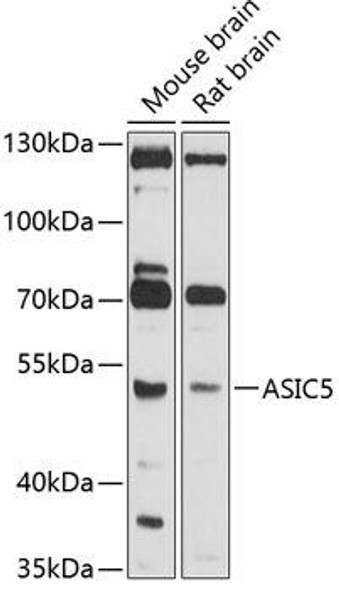 Anti-ASIC5 Antibody (CAB10307)