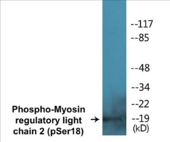 Myosin regulatory light chain 2 (Phospho-Ser18)Colorimetric Cell-Based ELISA Kit (CBCAB00010)