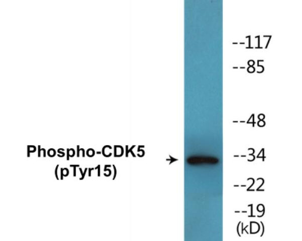 CDK5 (Phospho-Tyr15)Colorimetric Cell-Based ELISA Kit (CBCAB00011)
