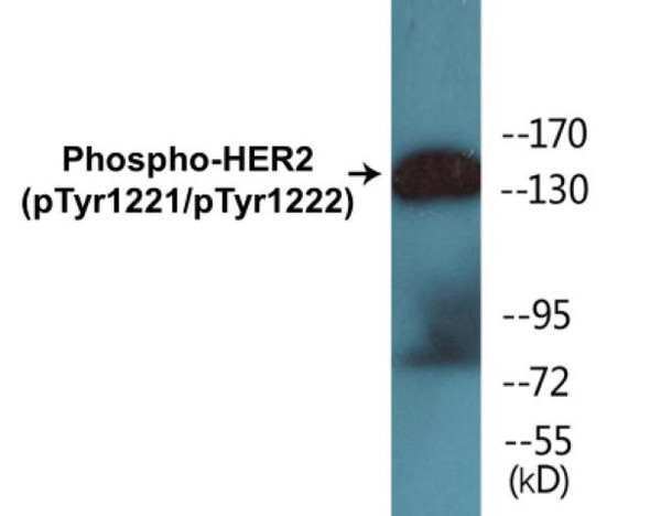 HER2 (Phospho-Tyr1221/Tyr1222)Colorimetric Cell-Based ELISA Kit (CBCAB00016)