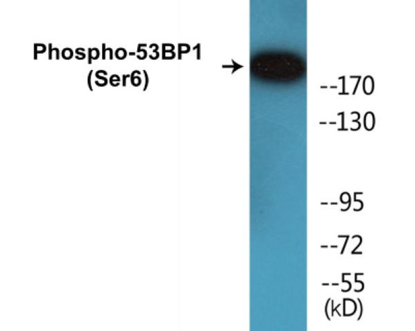 53BP1 (Phospho-Ser6)Colorimetric Cell-Based ELISA Kit (CBCAB00047)