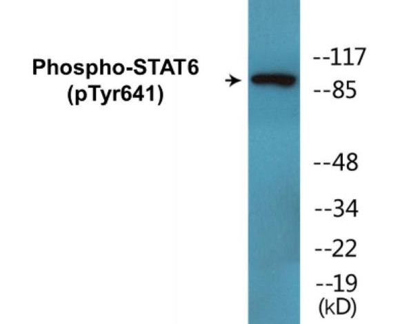 STAT6 (Phospho-Tyr641)Colorimetric Cell-Based ELISA Kit (CBCAB00060)