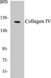 Collagen IV Colorimetric Cell-Based ELISA Kit (CBCAB00077)