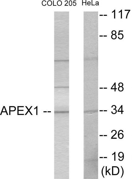 APEX1 Colorimetric Cell-Based ELISA (CBCAB00091)