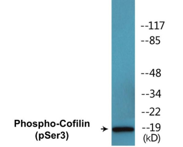 Cofilin (Phospho-Ser3)Colorimetric Cell-Based ELISA Kit (CBCAB00102)