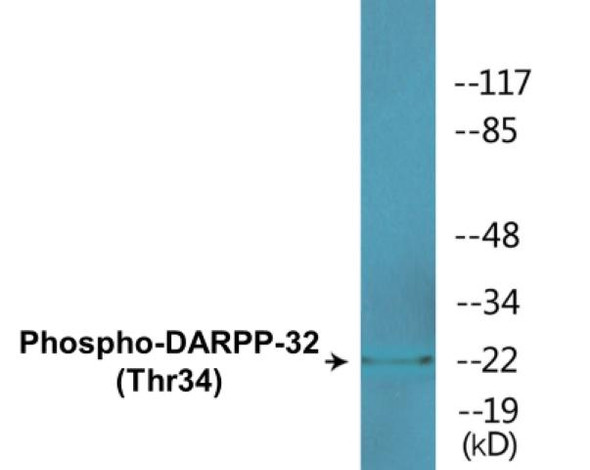 DARPP-32 (Phospho-Thr34)Colorimetric Cell-Based ELISA Kit (CBCAB00103)