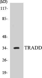 TRADD Colorimetric Cell-Based ELISA Kit (CBCAB00133)