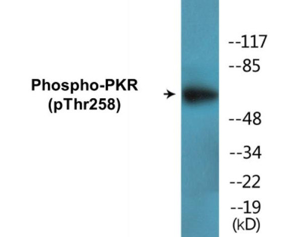 PKR (Phospho-Thr258)Colorimetric Cell-Based ELISA Kit (CBCAB00150)