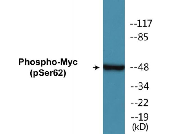 Myc (Phospho-Ser62)Colorimetric Cell-Based ELISA Kit (CBCAB00218)