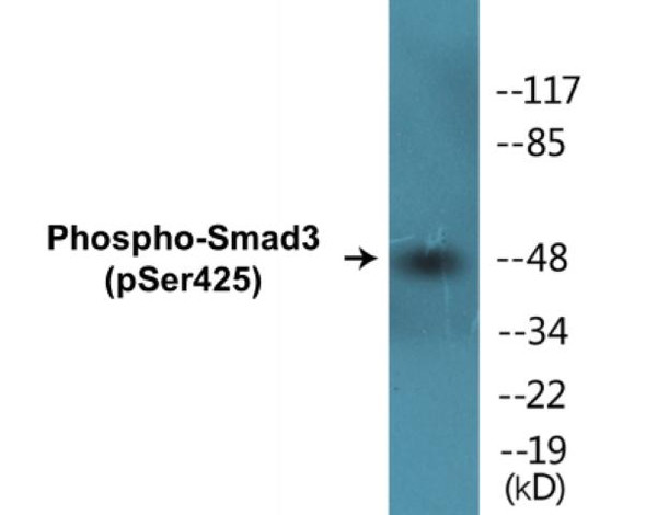Smad3 (Phospho-Ser425)Colorimetric Cell-Based ELISA Kit (CBCAB00220)