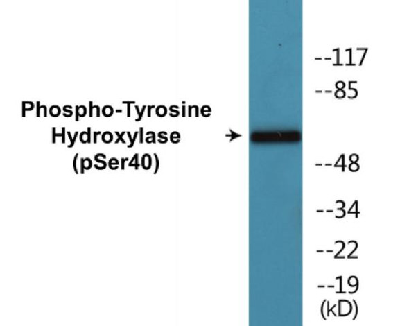 Tyrosine Hydroxylase (Phospho-Ser40)Colorimetric Cell-Based ELISA Kit (CBCAB00221)