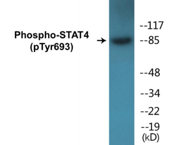 STAT4 (Phospho-Tyr693)Colorimetric Cell-Based ELISA Kit (CBCAB00223)