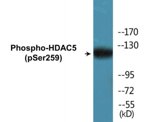 HDAC5 (Phospho-Ser259)Colorimetric Cell-Based ELISA Kit (CBCAB00230)
