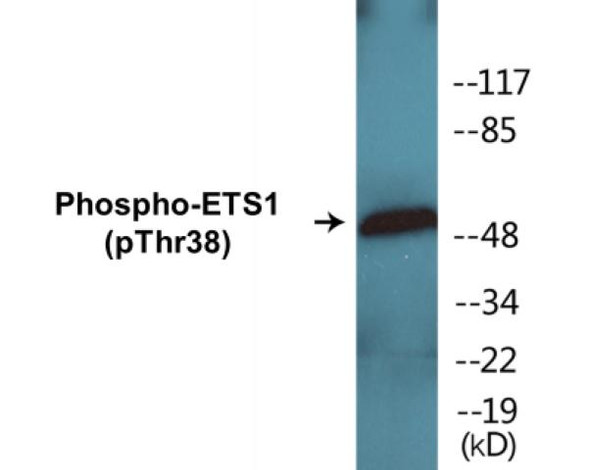 ETS1 (Phospho-Thr38)Colorimetric Cell-Based ELISA Kit (CBCAB00234)