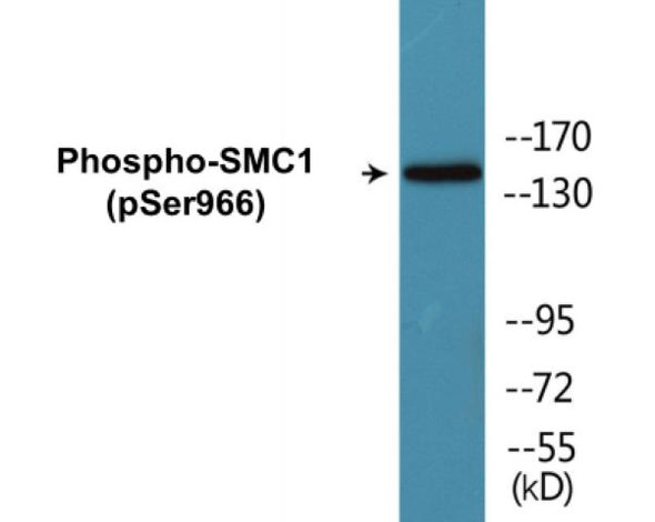 SMC1 (Phospho-Ser966)Colorimetric Cell-Based ELISA Kit (CBCAB00237)