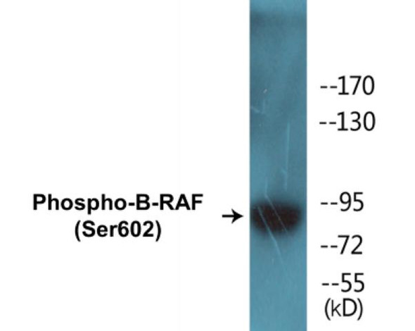 B-RAF (Phospho-Ser602)Colorimetric Cell-Based ELISA Kit (CBCAB00242)