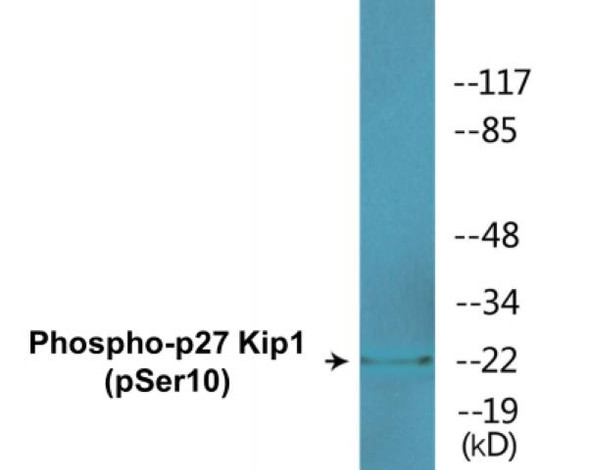 p27 Kip1 (Phospho-Ser10)Colorimetric Cell-Based ELISA Kit (CBCAB00256)