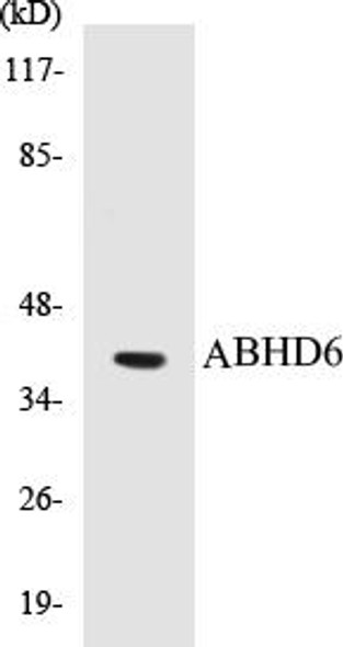ABHD6 Colorimetric Cell-Based ELISA Kit (CBCAB00271)
