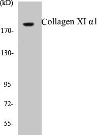 Collagen XI alpha1 Colorimetric Cell-Based ELISA Kit (CBCAB00287)
