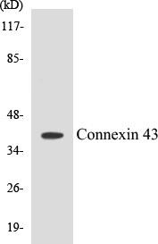 Connexin 43 Colorimetric Cell-Based ELISA Kit (CBCAB00288)
