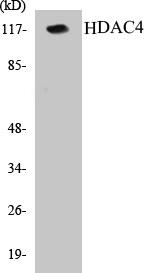 HDAC4 Colorimetric Cell-Based ELISA Kit (CBCAB00309)
