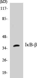 IkappaB-beta Colorimetric Cell-Based ELISA Kit (CBCAB00317)