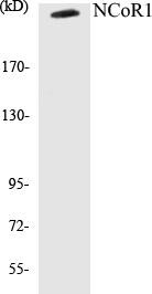 NCoR1 Colorimetric Cell-Based ELISA Kit (CBCAB00334)