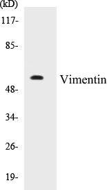 Vimentin Colorimetric Cell-Based ELISA Kit (CBCAB00372)