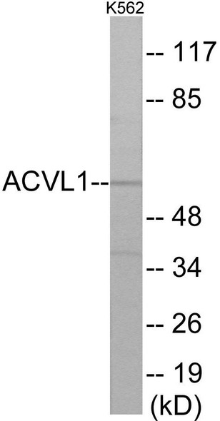 ACVL1 Colorimetric Cell-Based ELISA (CBCAB00380)