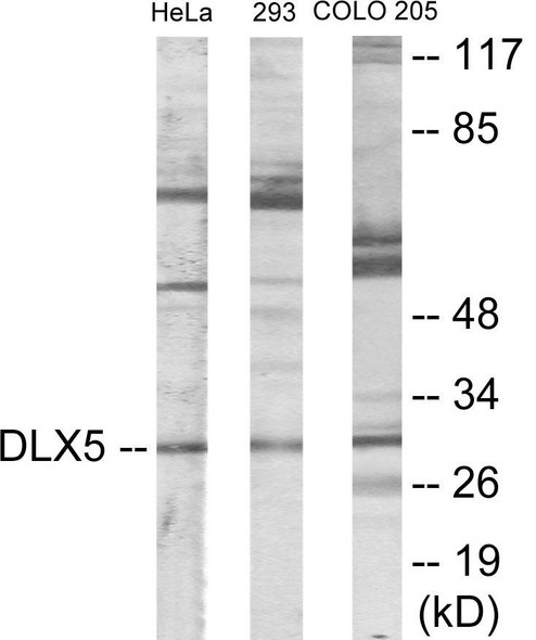 DLX5 Colorimetric Cell-Based ELISA (CBCAB00383)