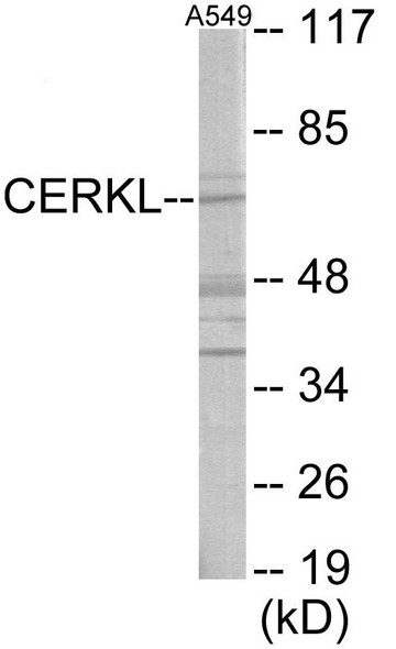 CERKL Colorimetric Cell-Based ELISA (CBCAB00387)