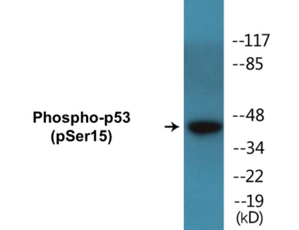 p53 (Phospho-Ser15)Colorimetric Cell-Based ELISA Kit (CBCAB00479)